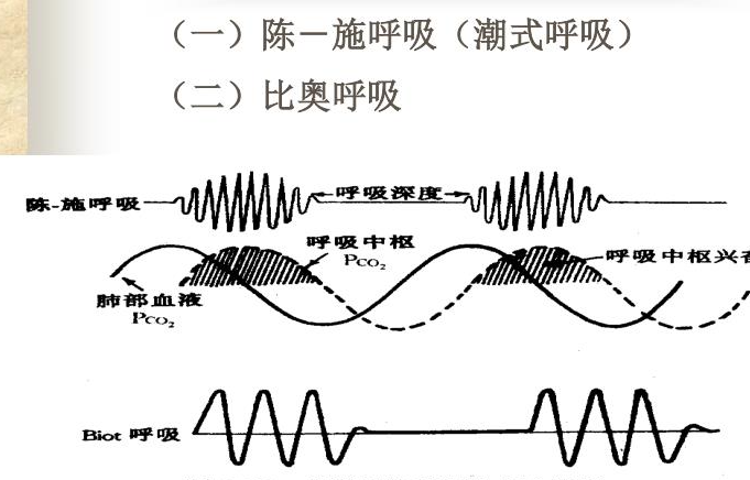 比奧呼吸 - 病理性的周期性呼吸