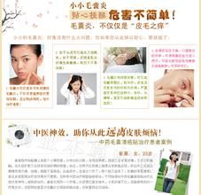 毛囊清瘡貼 - 治療毛囊炎的藥貼